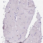 Immunohistochemical staining of human skeletal muscle shows no positivity in myocytes as expected.