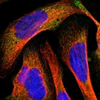 Immunofluorescent staining of human cell line U-2 OS shows localization to cytosol.