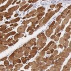 Anti-MYH7 Antibody