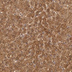 Anti-MPST Antibody