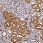 Immunohistochemical staining of human kidney shows moderate to strong granular cytoplasmic positivity in cells in tubules.