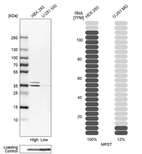 Western blot analysis in human cell lines HEK293 and U-251MG using Anti-MPST antibody. Corresponding MPST RNA-seq data are presented for the same cell lines. Loading control: Anti-PFN1.