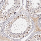 Immunohistochemical staining of human testis shows high expression.