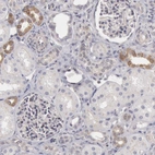 Immunohistochemical staining of human kidney shows low expression as expected.