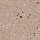 Immunohistochemical staining of human cerebral cortex shows moderate granular positivity in cytoplasm in neurons.