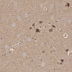 Immunohistochemical staining of human cerebral cortex shows moderate granular positivity in cytoplasm in neurons.