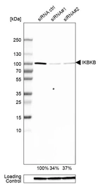 Western blot analysis in A-549 cells transfected with control siRNA, target specific siRNA probe #1 and #2, using Anti-IKBKB antibody. Remaining relative intensity is presented. Loading control: Anti-GAPDH.