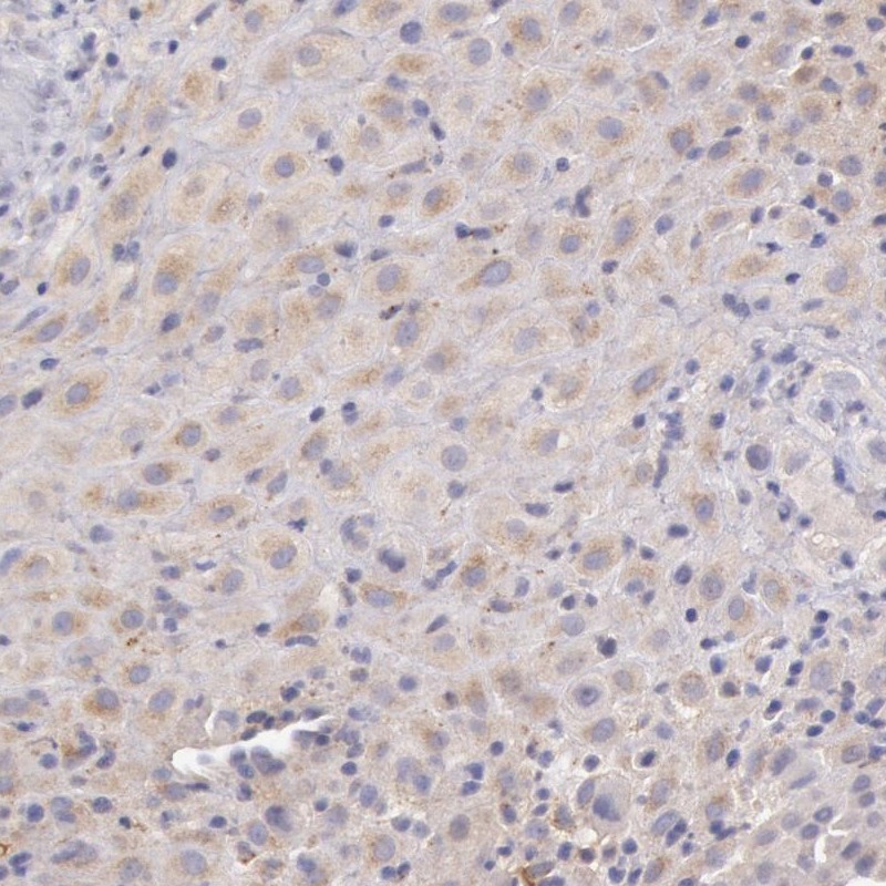 Anti-C1R Antibody