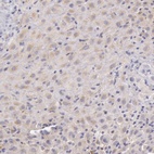 Anti-C1R Antibody