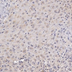 Anti-C1R Antibody