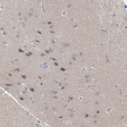 Immunohistochemical staining of human cerebral cortex shows moderate to strong cytoplasmic positivity in neurons.