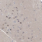 Immunohistochemical staining of human cerebral cortex shows moderate to strong cytoplasmic positivity in neurons.