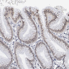 Immunohistochemical staining of human stomach shows weak to moderate nuclear positivity in glandular cells.