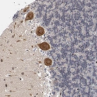 Immunohistochemical staining of human cerebellum shows moderate to strong cytoplasmic positivity in purkinje cells.
