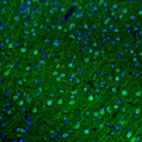Immunofluorescence staining of mouse cerebral cortex shows moderate to strong positivity in more than 75 % of neurons in the visual cortex.