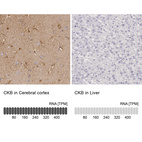 Anti-CKB Antibody