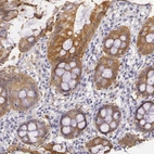 Immunohistochemical staining of human rectum shows moderate cytoplasmic positivity in glandular cells.