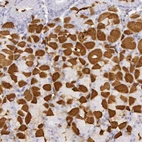Immunohistochemical staining of human stomach shows strong cytoplasmic positivity in parietal cells.