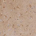 Immunohistochemical staining of human cerebral cortex shows weak to moderate cytoplasmic positivity in astrocytes.