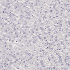 Immunohistochemical staining of human liver shows no positivity in hepatocytes as expected.