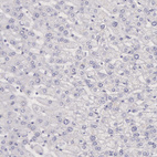 Anti-CKB Antibody