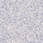 Immunohistochemical staining of human liver shows no positivity in hepatocytes as expected.