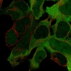 Immunofluorescent staining of human cell line HEK 293 shows localization to cytosol.
