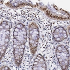 Immunohistochemical staining of human colon shows moderate to strong nuclear positivity in glandular cells.