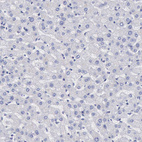 Immunohistochemical staining of human liver shows no positivity in hepatocytes as expected.