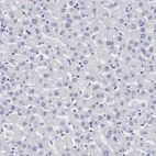 Immunohistochemical staining of human liver shows no positivity in hepatocytes as expected.