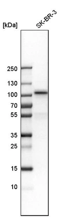 Western blot analysis in human cell line SK-BR-3.