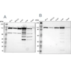 Western blot analysis using Anti-MTHFD1 antibody HPA001290 (A) shows similar pattern to independent antibody HPA000704 (B).