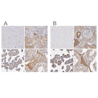 Immunohistochemical staining of human cerebral cortex, kidney, placenta and testis using Anti-SERPINA1 antibody HPA001292 (A) shows similar protein distribution across tissues to independent antibody HPA000927 (B).