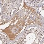 Immunohistochemical staining of human testis shows moderate positivity in plasma.