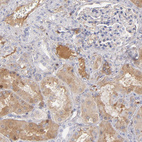 Immunohistochemical staining of human kidney shows moderate positivity in plasma.