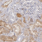Immunohistochemical staining of human kidney shows moderate positivity in plasma.