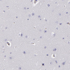 Anti-SERPINA1 Antibody