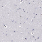 Immunohistochemical staining of human cerebral cortex shows no positivity in neurons as expected.