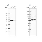 Western blot analysis using Anti-SERPINA1 antibody HPA001292 (A) shows similar pattern to independent antibody HPA000927 (B).