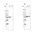 Western blot analysis using Anti-SERPINA1 antibody HPA001292 (A) shows similar pattern to independent antibody HPA000927 (B).
