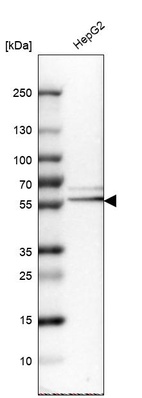 Anti-SERPINA1 Antibody