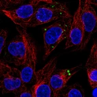 Immunofluorescent staining of human cell line Hep G2 shows localization to vesicles.