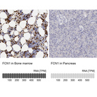 Anti-FCN1 Antibody