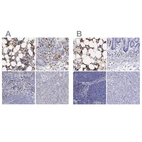 Immunohistochemical staining of human bone marrow, gastrointestinal, lymphoid tissues and pancreas using Anti-FCN1 antibody HPA001295 (A) shows similar protein distribution across tissues to independent antibody HPA000685 (B).