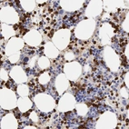 Immunohistochemical staining of human bone marrow shows strong cytoplasmic positivity in hematopoietic cells.