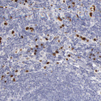 Anti-FCN1 Antibody