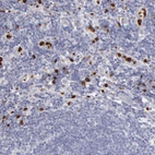 Immunohistochemical staining of human lymph node shows strong cytoplasmic positivity in non-germinal center cells.