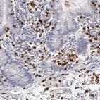 Immunohistochemical staining of human small intestine shows strong cytoplasmic positivity in lymphoid cells.