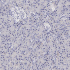 Immunohistochemical staining of human pancreas shows no positivity in exocrine glandular cells as expected.