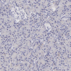 Anti-FCN1 Antibody